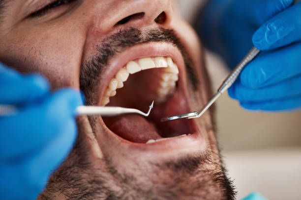 Best Walk-In Emergency Dentist in Lakewood, WA