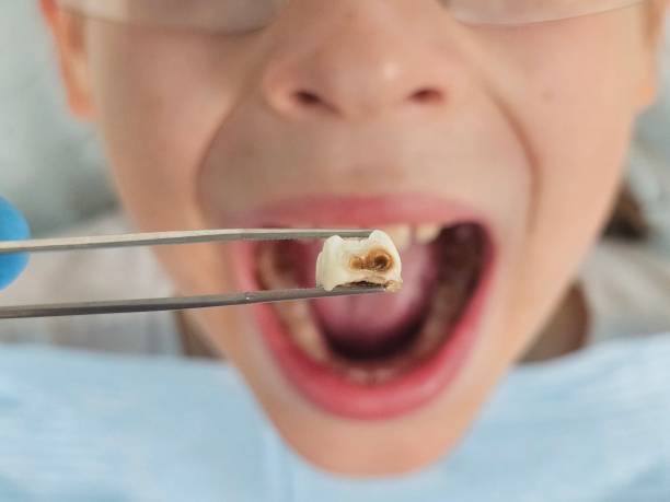 Best Walk-In Emergency Dentist in Lakewood, WA